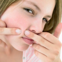 Symptomen acne
