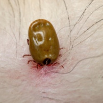 Ziekte van Lyme voorkomen