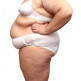 Obesitas