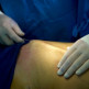 Liposuctie: de operatie