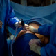 Liposuctie of liposculptuur