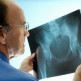 Osteoporose
