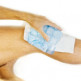 Behandeling slijmbeursontsteking