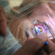 Behandeling van cataract