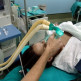 Coma