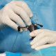 Behandeling van een liesbreuk