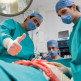 Hoe gaat een hysterectomie in zijn werk?