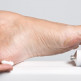 Behandeling eelt
