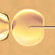 In-vitrofertilisatie of IVF